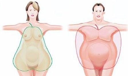 Ожирение - причины и лечение