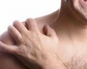Бурсит плечевого сустава - симптомы и лечение