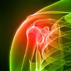 Артроз плечевого сустава - симптомы, лечение