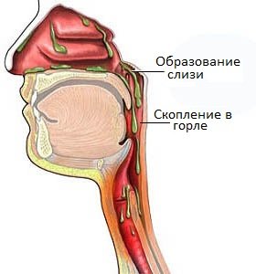 Образование слизи, и скопление ее в горле