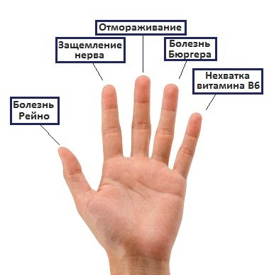 Причины онемения пальцев на руках