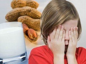 пищевая аллергия