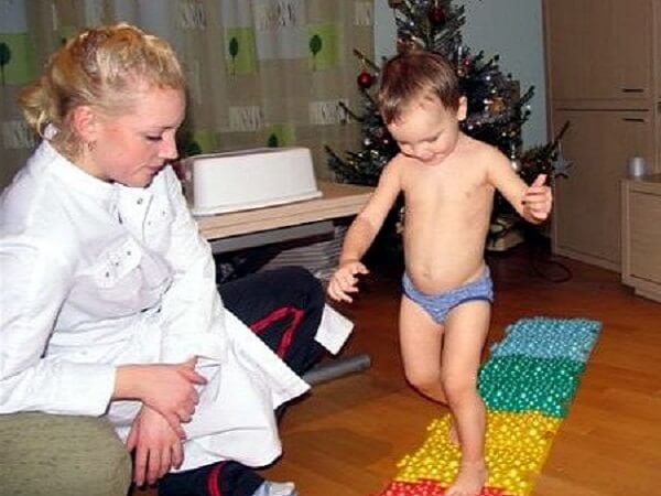 Лечение плоскостопия у детей