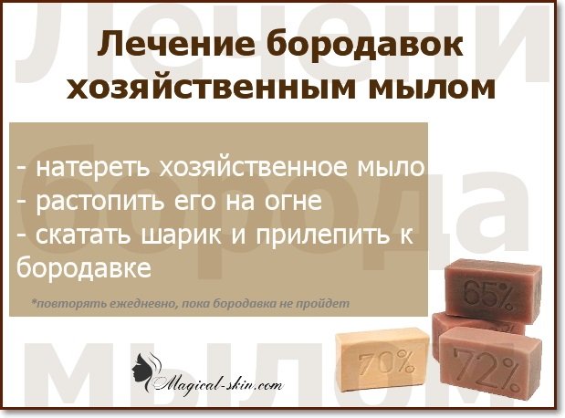 Заговор на бородавки на луну. Хозяйственное мыло от бородавок. Хозяйственное мыло от папиллом. Избавление от папиллом хозяйственным мылом. Избавление от папиллом с помощью хозяйственного мыла.