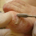 Засоби, які лікують грибок на нігтях ніг: огляд та відгуки
