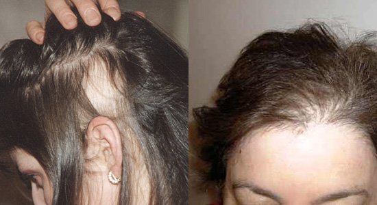 Выявляем проблемы сильного в падения волос