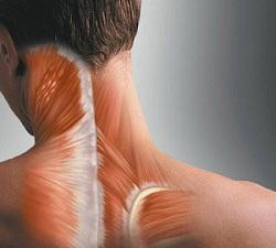 Спазм мышц шеи появляется после продолжительного нахождения шеи в неудобной позе