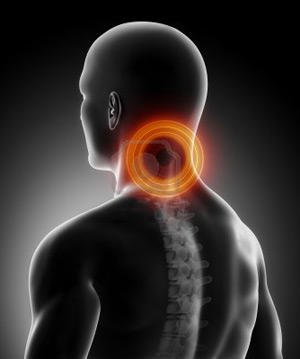 Причина появления болевых ощущений в области шеи — компрессия нервных окончаний и крупных кровеносных сосудов