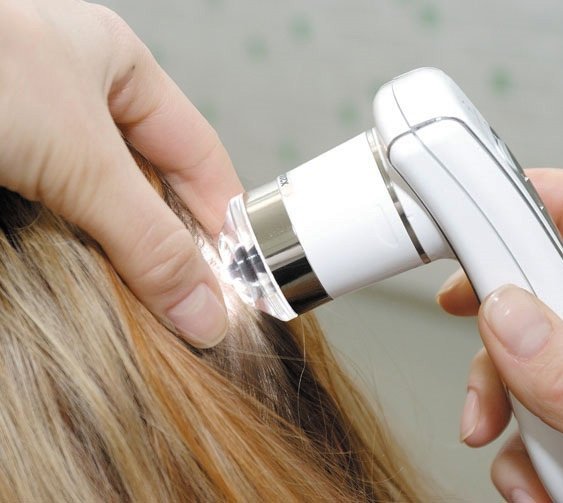 Аппаратное лечение выпадения волос