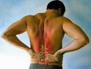Основной причиной боли вокруг поясницы может быть остеохондроз