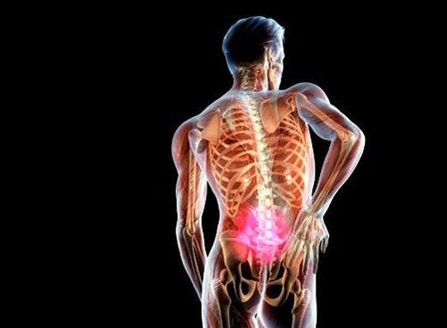 Киста - это новообразования на позвоночнике, которые могут вызвать болевые ощущения в спине