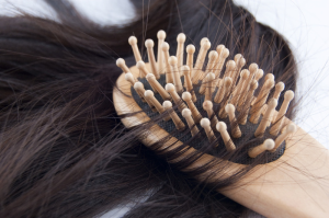 Выпадения волос при гипотиреозе