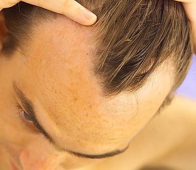Описание причин выпадения волос у мужчин
