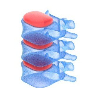 spine_cartilage