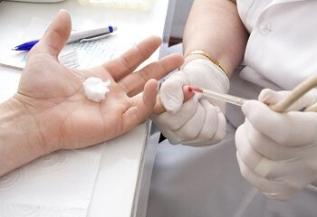 Как правильно сдать общий анализ крови