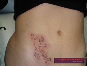 Скрыть шрам татуировкой