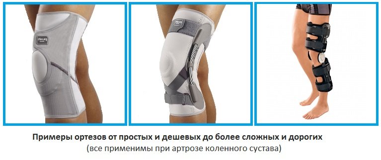 Примеры ортезов, применяемых при артрозе коленного сустава