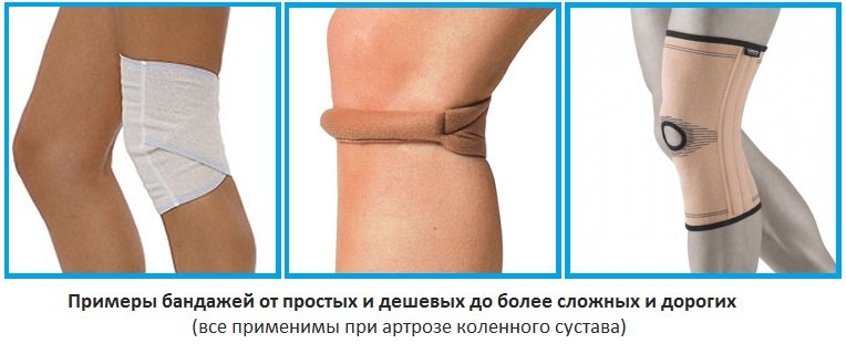 Примеры бандажей, применяемых при артрозе коленного сустава