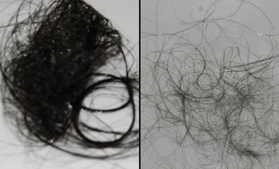 Потеря волос при мытье до и после курса Эсвицина