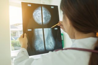 Підготовка до мамографії молочних залоз і правила проходження обстеження